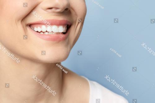 denplan-implants